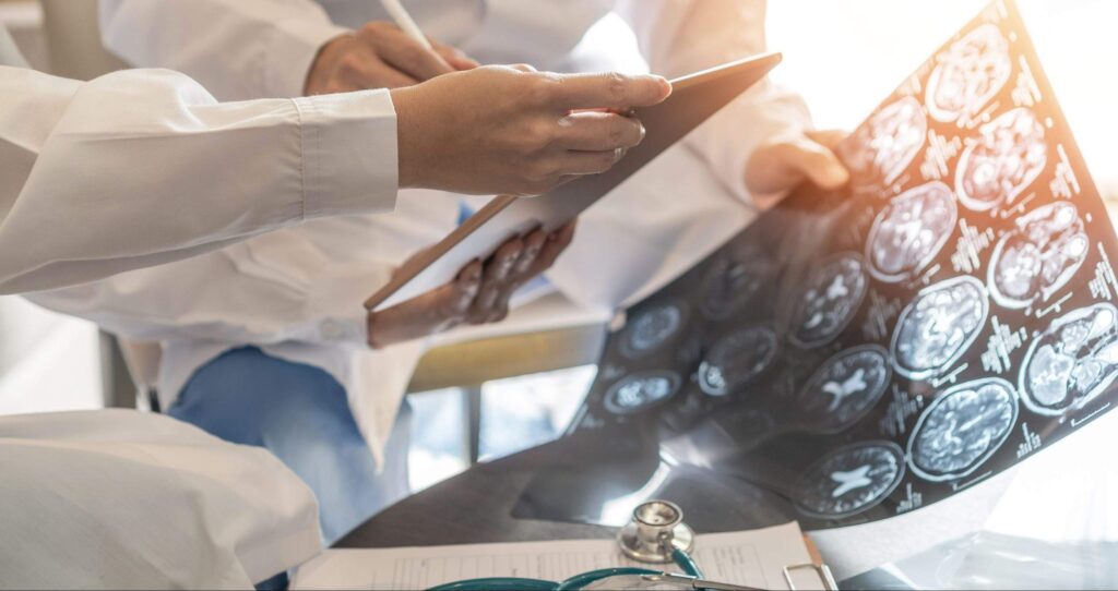 los angeles brain injury lawyer