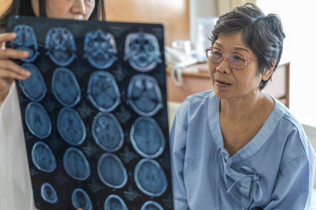 brain disease diagnosis with medical doctor diagnosing elderly ageing patient neurodegenerative illness problem seeing magnetic resonance imaging (mri) film for neurological medical treatment. Who is most at risk for Acquired Brain Injury?