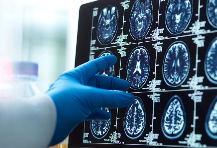 Can a nose injury cause brain damage?