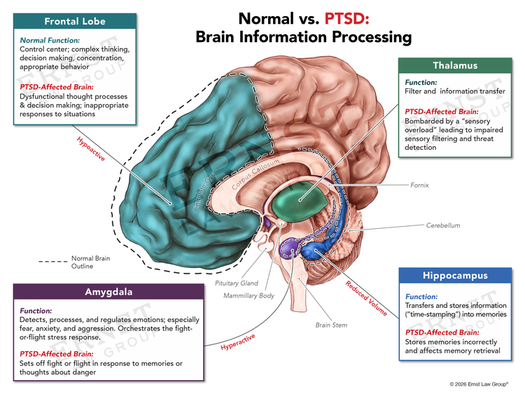 exhibit 1c normal vs ptsd brain circuitry wm