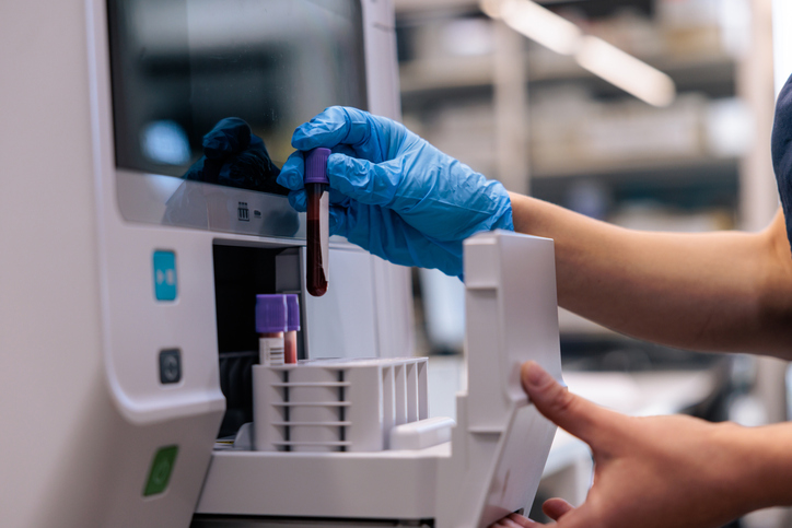 Lab specialist handling blood vials - Is there a blood test for brain injury approved by the FDA?